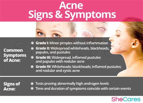 Acne | SheCares