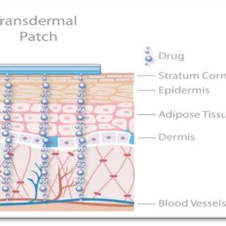 Diagram of Skin Along with Transdermal Patch 1.5. Types of transdermal ...