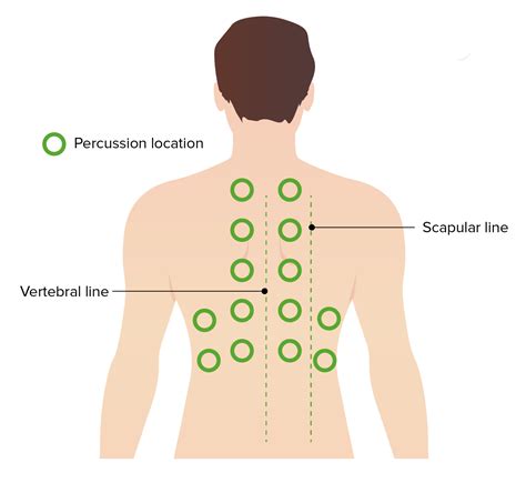 Pulmonary Examination | Concise Medical Knowledge