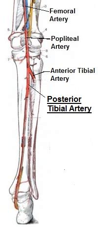 Tibial arteries