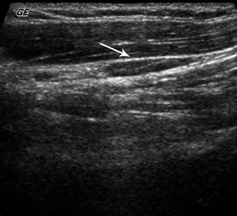 Current Concepts in Lymph Node Imaging | Journal of Nuclear Medicine