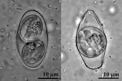 Morphologic and Molecular Characterization of Isospora belli Oocysts ...