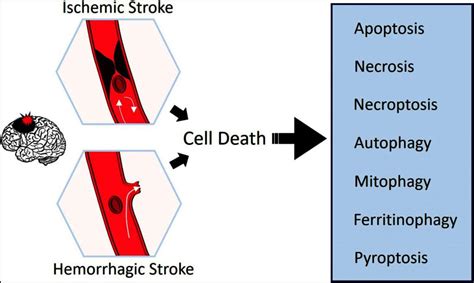 Cell death mechanisms in stroke and novel molecular and cellular treatment options | BIOENGINEER.ORG