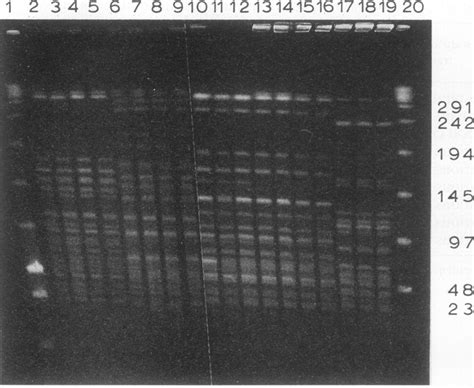 PFGE analysis of genomic DNA from A. baumannii isolates of different... | Download Scientific ...