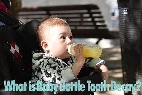 Prevent Baby Bottle Tooth Decay | Growing Smiles of Voorhees