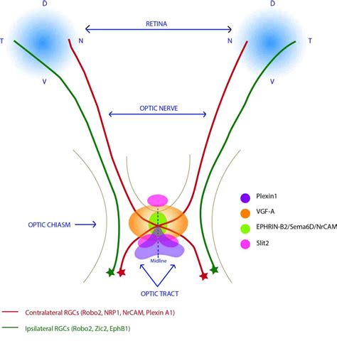 Optic Chiasm | History, Location, Syndromes & Physiology