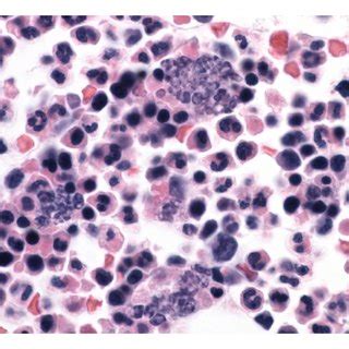 Macrophage Histology