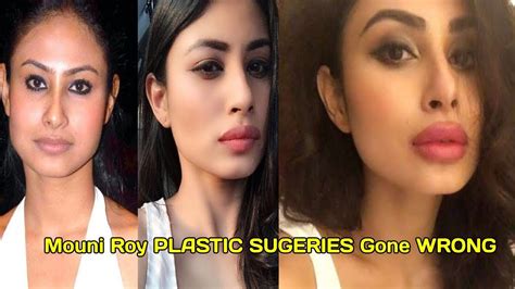 Mouni Roy Lip Surgery : Surgery Plastic Rvcj Mouni Roy Before Tv | komoiyo