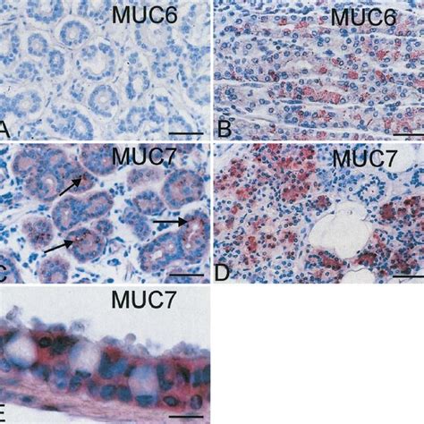 Mucin mRNA expression in tissue specimens from 34 cadavers | Download Table