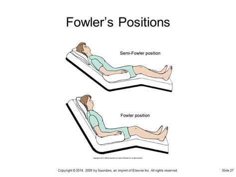 Fowlers Position