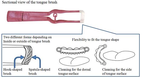 Change of Oral Conditions after Combined Use of a Tongue Brush and ...