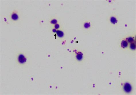 Budding Yeast Gram Stain