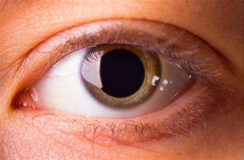 How Long Does Eye Dilation Take to Wear Off⼁Calgary