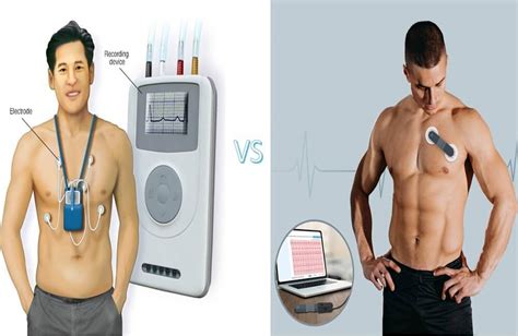 A Comparison of Holter Monitor and Wellue 24-Hour ECG Recorder with AI