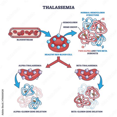 Thalassemia blood disease as hemoglobin structure deletion outline ...