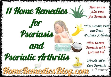 The Top 11 Home Remedies for Psoriasis and Psoriatic Arthritis - Home Remedies Blog