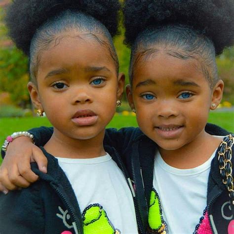 The Truth Behind True Blue Twins Gone Viral | Woman Mgzn