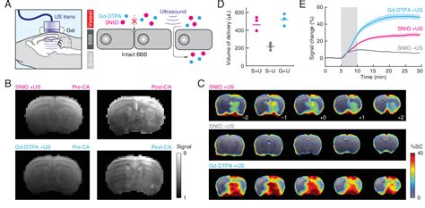 [PDF] Single-nanometer iron oxide nanoparticles as tissue-permeable MRI contrast agents ...