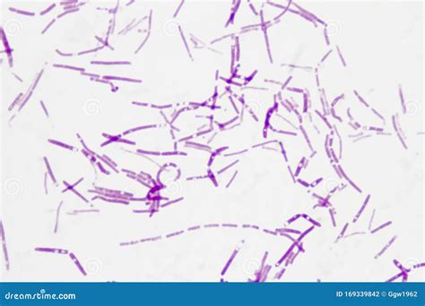 Gram Negative Rods Stock Photo | CartoonDealer.com #169339842