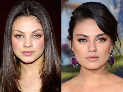 Mila Kunis plastic surgery enhancements?