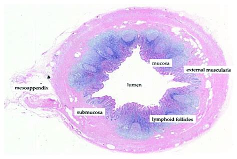 What Is The Vermiform Appendix