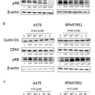 The effect of L-KYN, KYNA and FICZ on AHR gene expression in melanoma ...