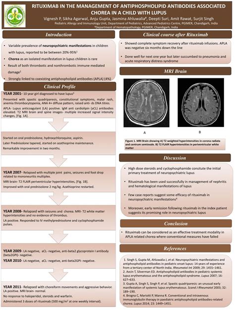 Clinical course after Rituximab - ppt download