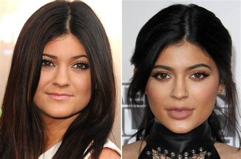 Kylie Jenner is unrecognisable in old pics pre-lip fillers | Daily Star