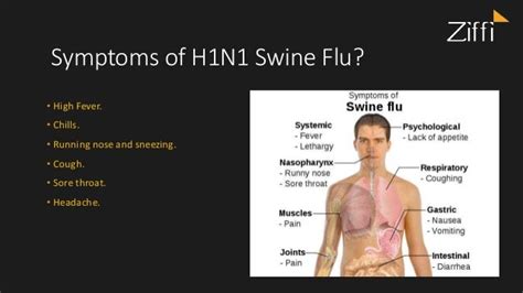 H1N1 Swine Flu: Symptoms, Causes, Prevention, Tests and Vaccination