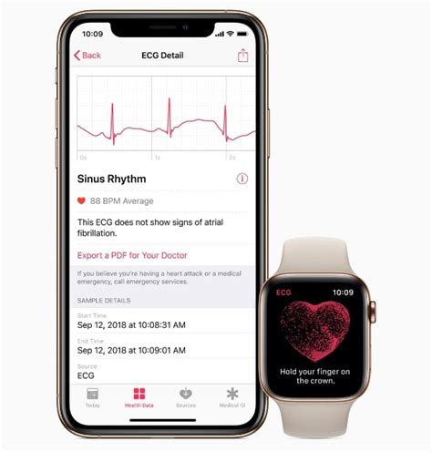 Apple Watch Series 4 ECG Feature Rolls Out Today With watchOS 5.1.2 ...