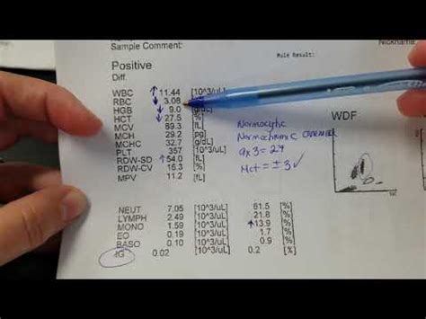 Hematology: How to interpret automated Complete Blood Count (CBC) results - YouTube