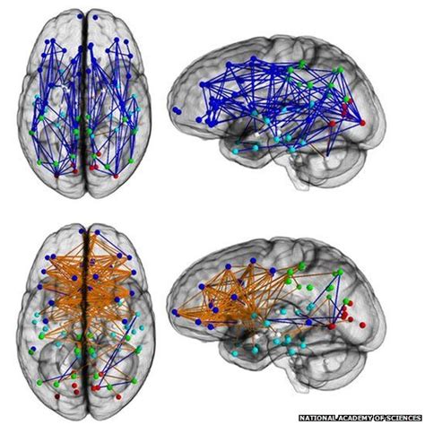 Men and women's brains are 'wired differently' - BBC News