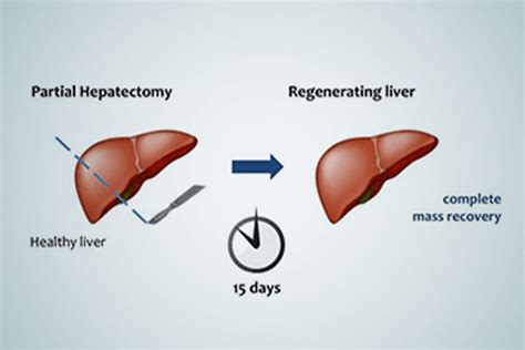 Liver Regeneration & its Process – Dr Faisal Dar