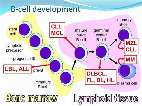 Chronic lymphocytic leukemia Chronic Lymphocytic Leukemia Small