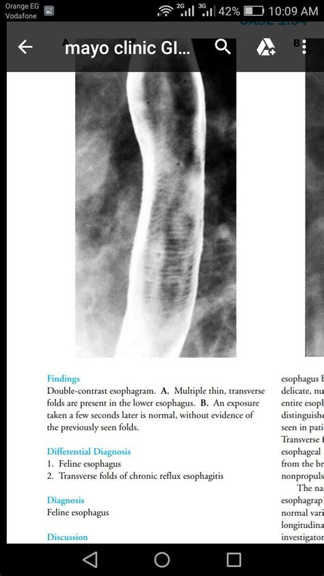 #double contrast esophogram .#feline esophagus. | X ray, Radiology, Contrast