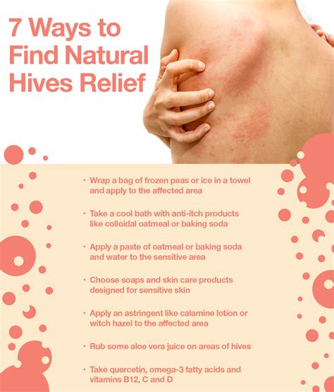 What Stops Hives From Itching Fast