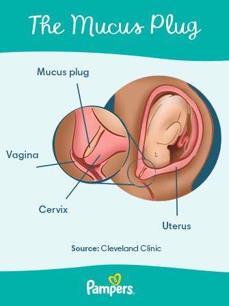 Mucus Plug Discharge Pieces