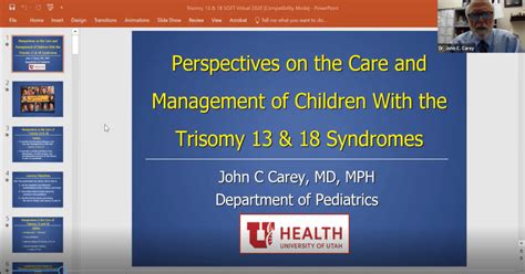 Video - Perspectives on the Care of Children with Trisomy 18 and 13 - SOFT - Support ...