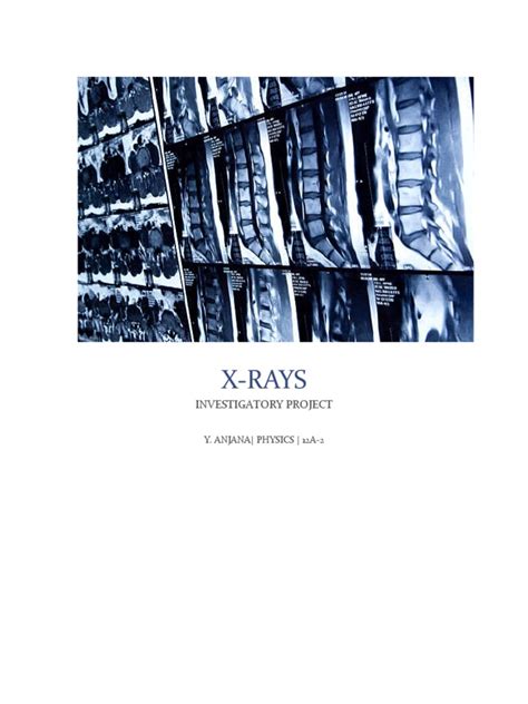 Understanding X-Rays: Properties, Procedures, Benefits, and Risks | PDF ...