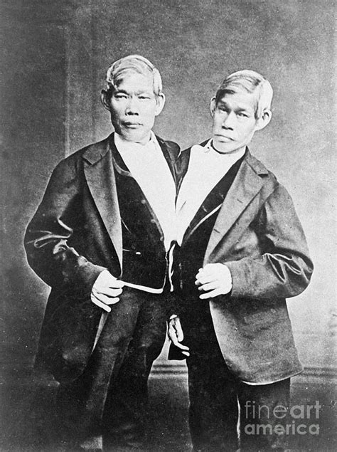 Chang And Eng, Siamese Twins Photograph by Wellcome Images - Fine Art America