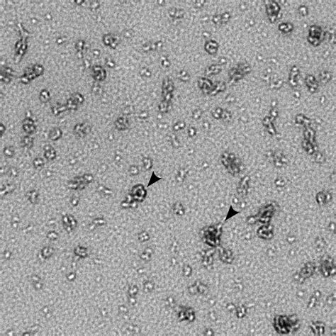 Chlamydia trachomatis Bacteria and the PmpD Protein | Flickr