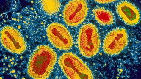 Smallpox general in US university row - BBC News