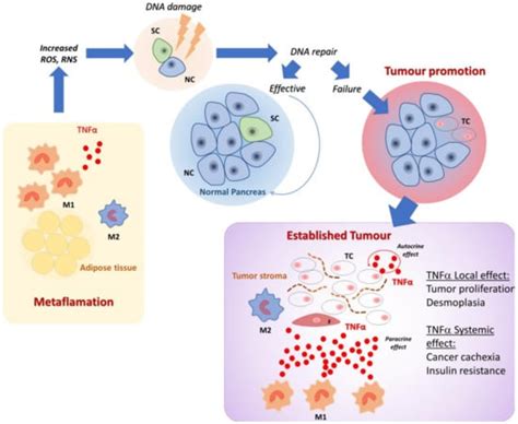 IJMS | Free Full-Text | Inflammation and Pancreatic Cancer: Focus on Metabolism, Cytokines, and ...