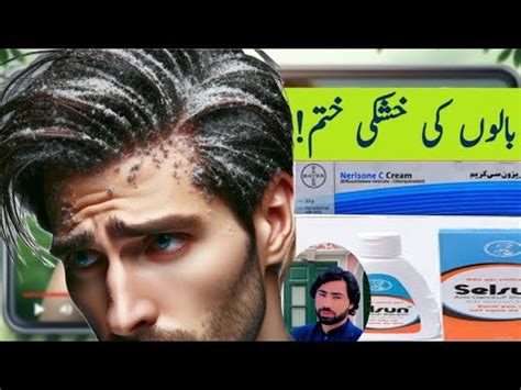 Seborrhoea disease | causes | symptoms | treatment | Urdu | hindi ...