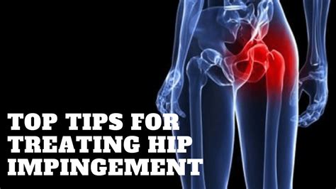 Treating Hip Impingement in the Fitness Athlete - The Barbell Physio