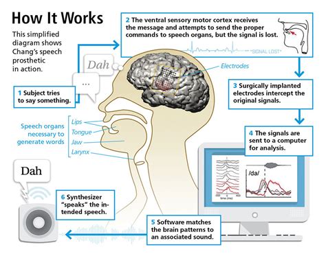 Brain-Machine Interface Could Give Voice to the Voiceless | Discover ...