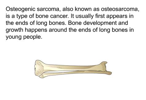 PatEdu.com : Osteogenic Sarcoma