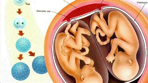 Everything You Need To Know About Fraternal and Identical Twins | Dr. Sarah Finch - YouTube