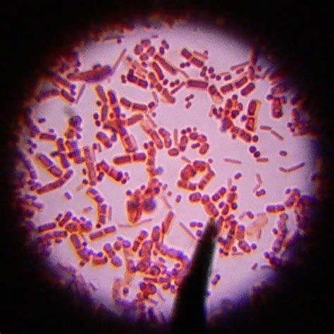 Bacteria | Bacilli and Cocci, colored with the Gram staining… | Flickr