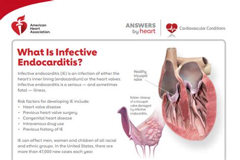 Heart Valves and Infective Endocarditis | American Heart Association